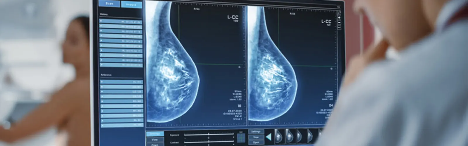What Is The Cost Of Mammography?